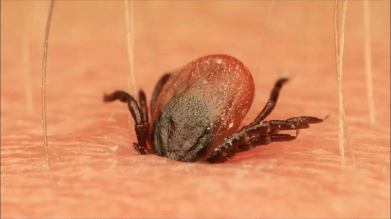 Плесневые клещи фото Eliminating ticks from my pet's rectum - YouTube