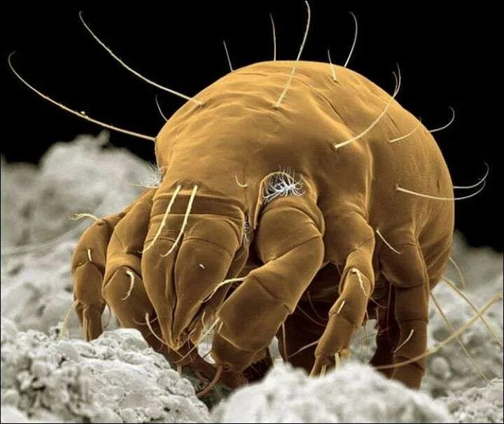 Плесневые клещи фото Microscope Insect Photography Insect photography, Electron microscope, Microscop
