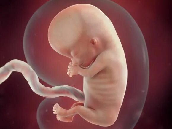 Плод 10 11 недель фото Fetal development by week: Your baby in the womb 11 weeks pregnant, Pregnancy we