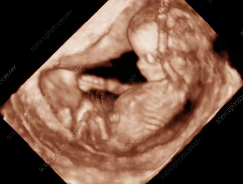 Плод 11 12 недель фото 12 week foetus, 3-D ultrasound scan - Stock Image - P680/0609 - Science Photo Li