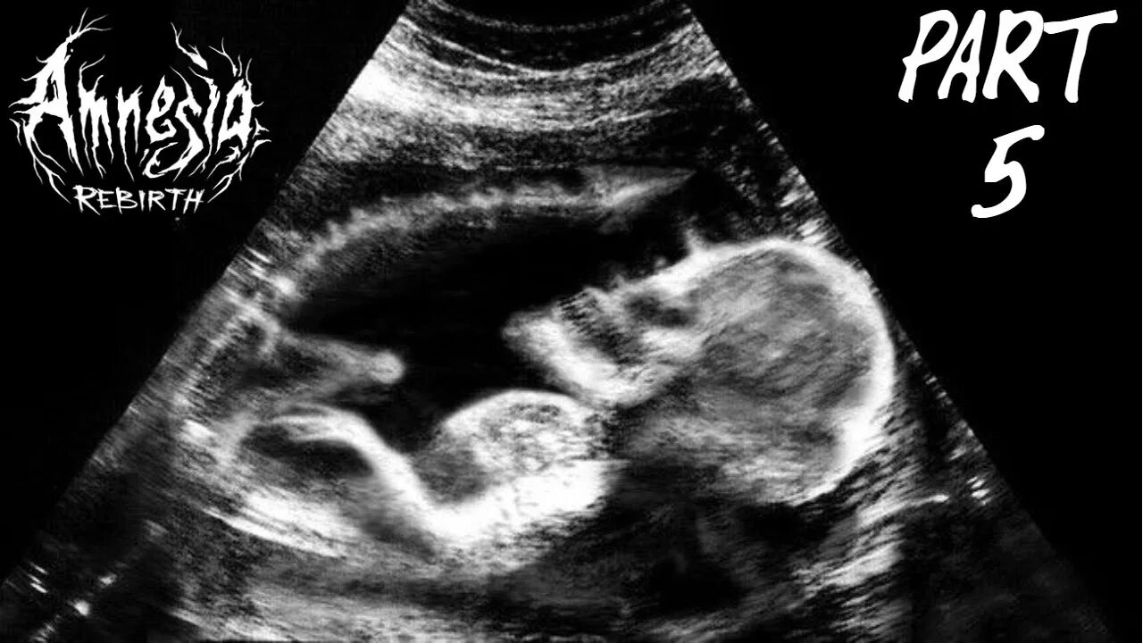 Плод 13 недель фото узи UNBORN SPIRIT BABY Amnesia Rebirth - Part 5 - YouTube