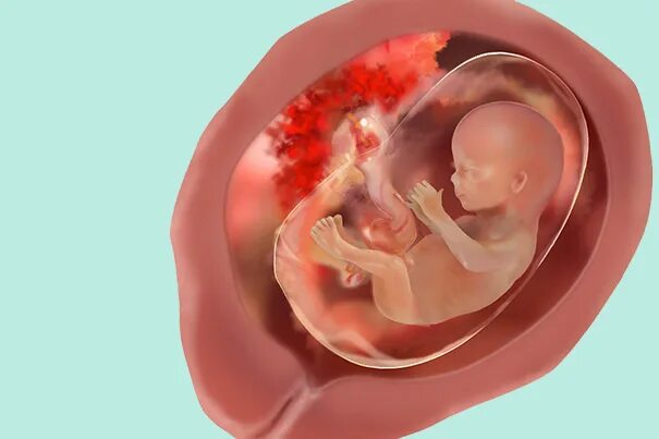 Плод 15 неделя фото Bebe 15 Semanas De Embarazo on Sale benzovoz.net