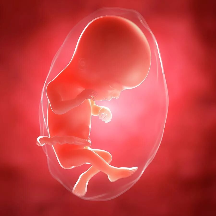Плод 16 недель фото как выглядит Foetus At 16 Weeks #2 Photograph by Sciepro/science Photo Library - Fine Art Ame