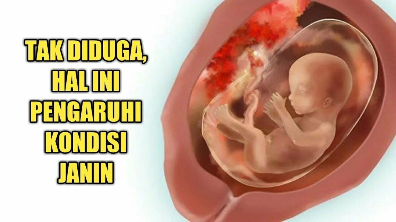Плод 16 недель фото как выглядит Hal yang Tidak Terduga namun bisa Mempengaruhi Kondisi Janin - YouTube