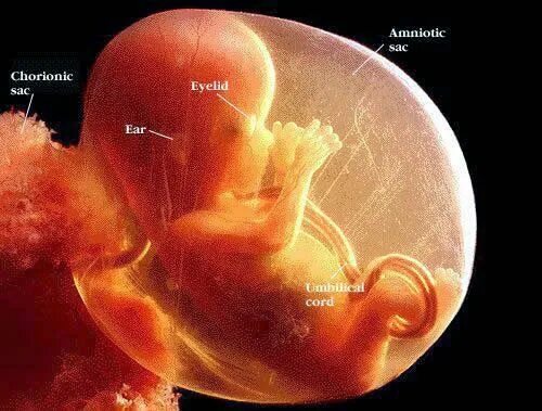 Плод 16 недель фото как выглядит Pin em Pregnancy week by week