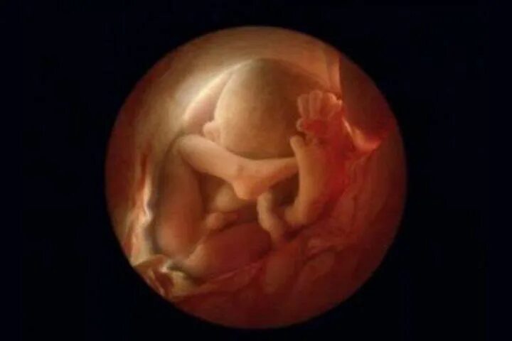 Плод 16 недель фото как выглядит 15 Stunning Images Of Life Inside The Womb Life images, Womb, Fetal development
