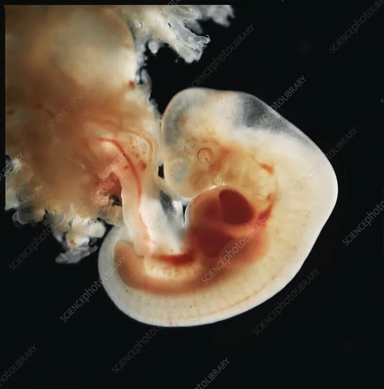 Плод 3 месяца фото Embryo, five weeks - Stock Image - C048/7948 - Science Photo Library