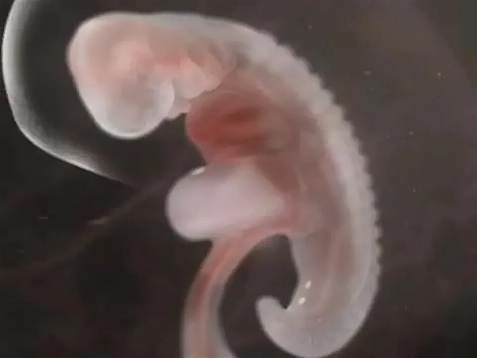 Плод 3 месяца фото Pin en Maternity