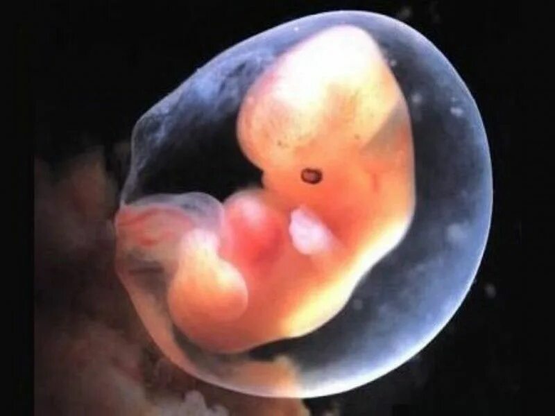 Плод 3 месяца фото Pin on Aborto