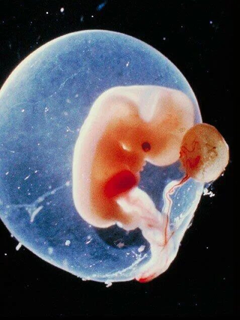 Плод 5 6 недель фото "Un embrión no es una persona": doctor en ciencias de la UNAM - Cultura Colectiv