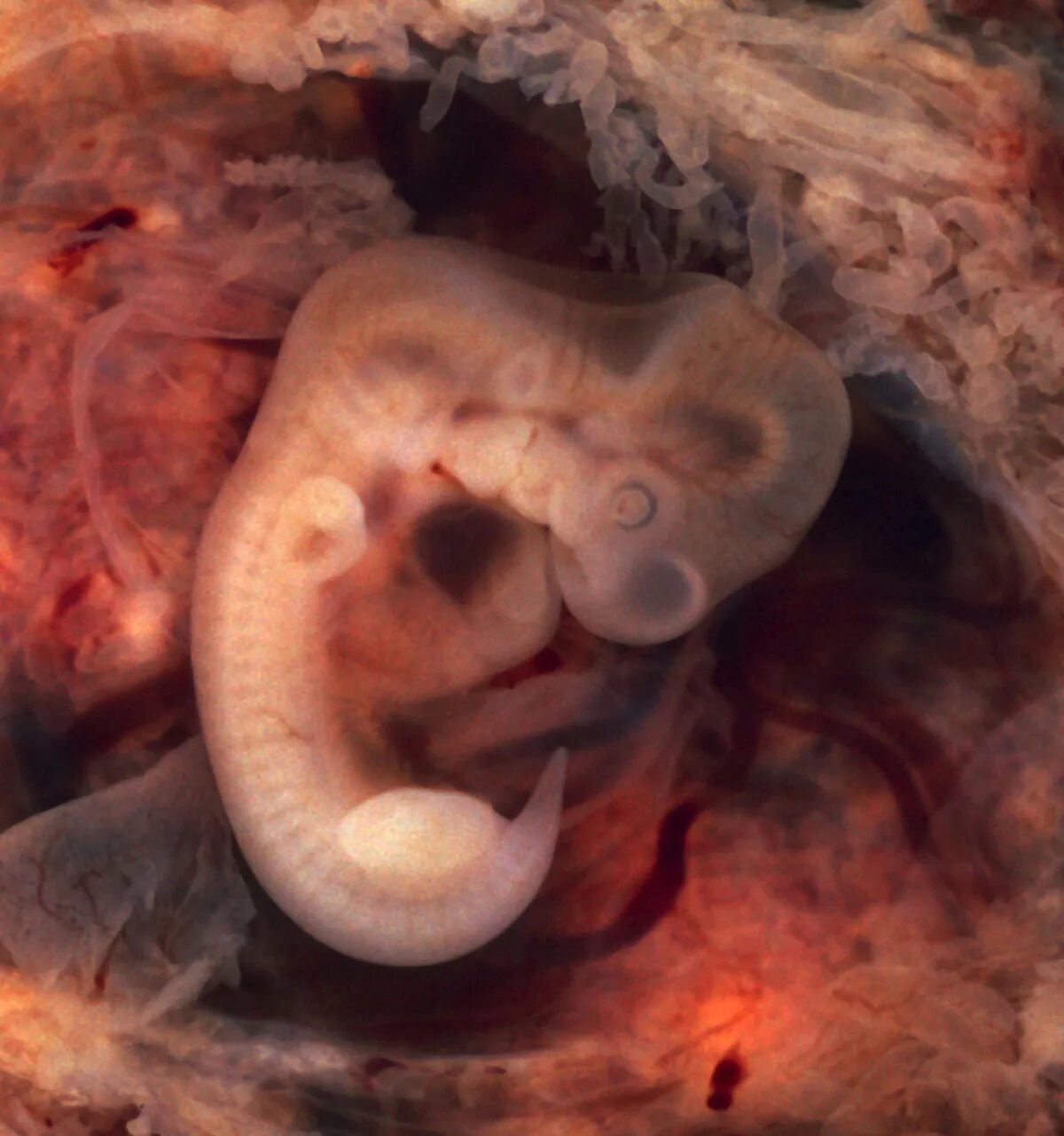 Плод 5 6 недель фото Файл:Tubal Pregnancy with embryo.jpg - Вікіпедыя