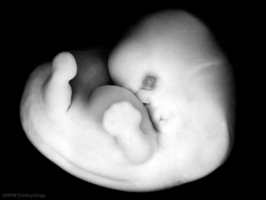 Плод 6 7 фото Carnegie stage 18 - Embryology