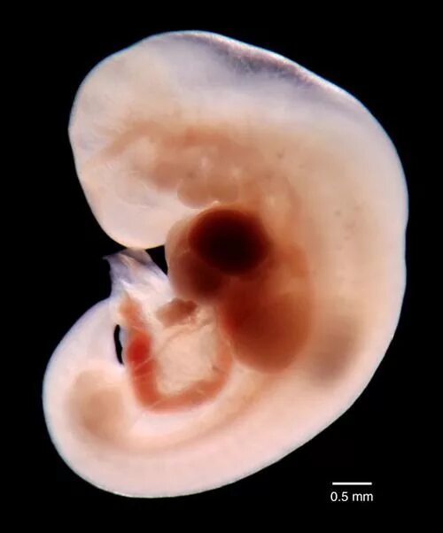 Плод 6 7 фото Medical School Human embryo, Human anatomy art, Medical illustration