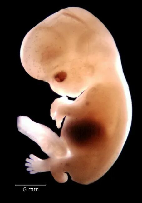Плод 6 7 недель фото First trimester, Fetal development, Trimester
