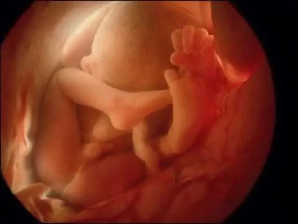 Плод 6 месяцев фото DESARROLLO EMBRIONARIO Y FETAL. - YouTube