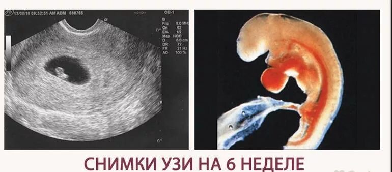 Плод 6 недель фото 6 неделя беременности