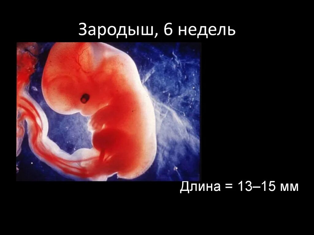 Плод 6 недель фото 6 недель беременности: найдено 83 изображений