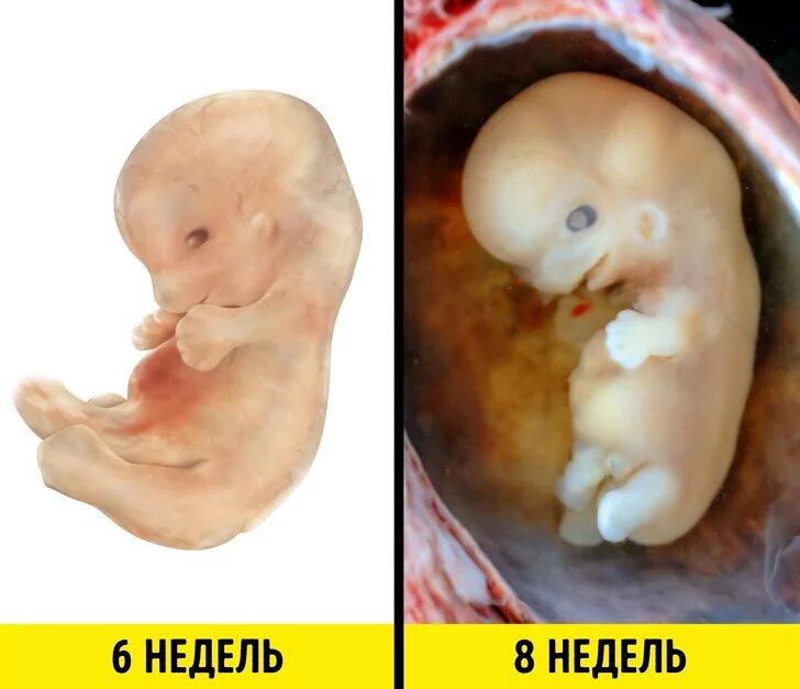 Плод 6 недель фото Чем занимается ребенок, пока находится у мамы в животе (812) 337-12-12