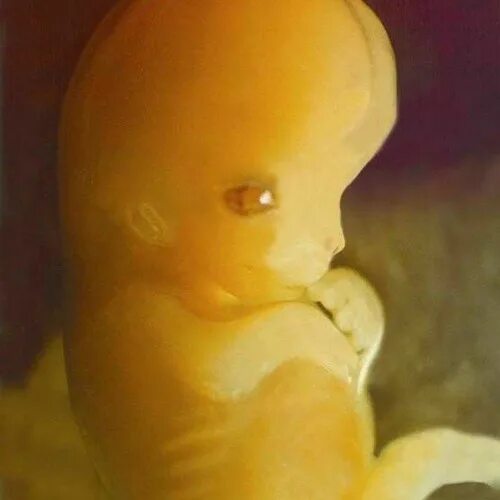 Плод 7 недель фото Stream 17.Anticonceptivos y aborto from ADORACION PROVIDA Listen online for free