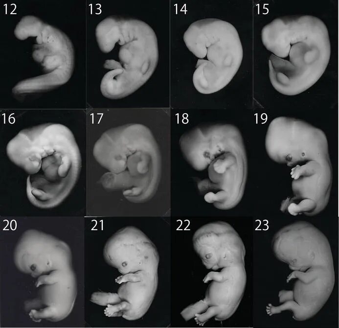Плод по месяцам фото Congenital Anomalies in Human Embryos IntechOpen