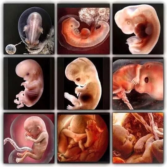 Плод по месяцам фото Log In or Sign Up to View Baby art, Baby development in womb, Baby development