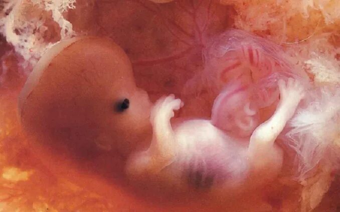 Плод ребенка 12 недель фото Aborto e scuola: dire la verità è indottrinamento?
