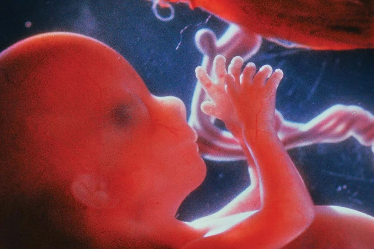 Плод ребенка 16 недель фото Do animals cut the umbilical cord of newborns like humans do? New Scientist