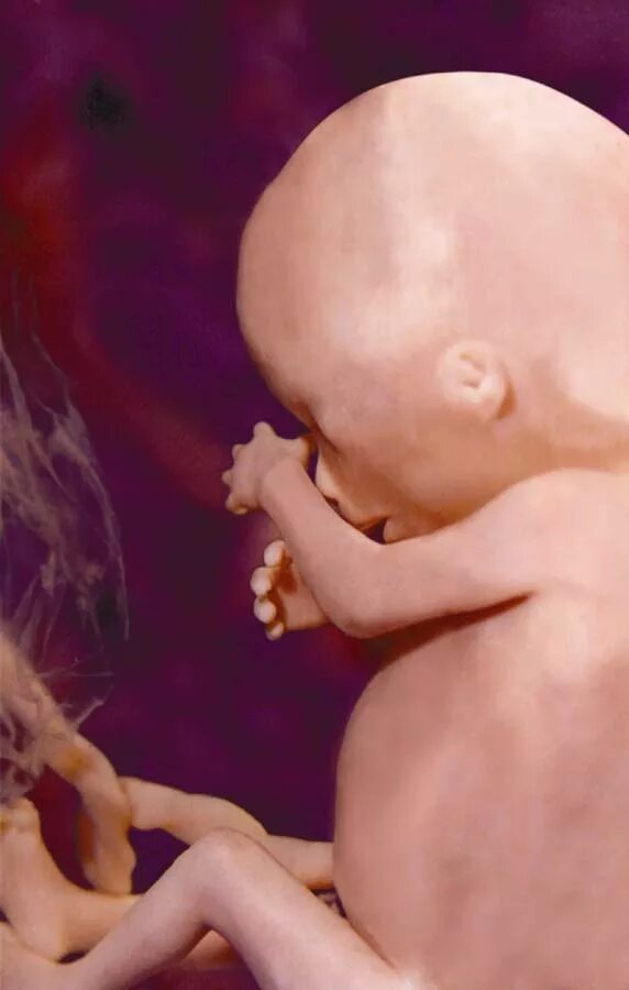 Плод ребенка 16 недель фото THE O'REILLY FACTOR GUESTS: Joe Scheidler, Fay Clayton ( abortion