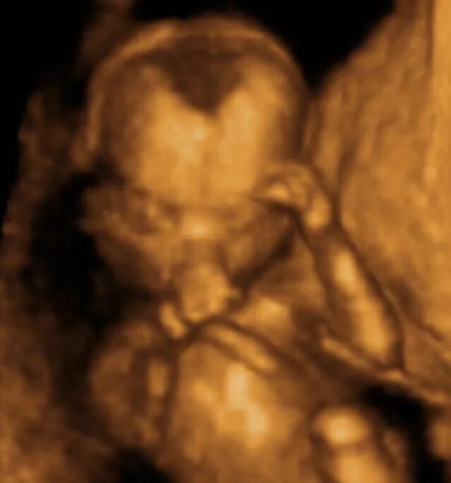 Плод ребенка 16 недель фото Week 16 of Your Pregnancy Baby scan, Pregnancy week by week, 16 weeks pregnant u