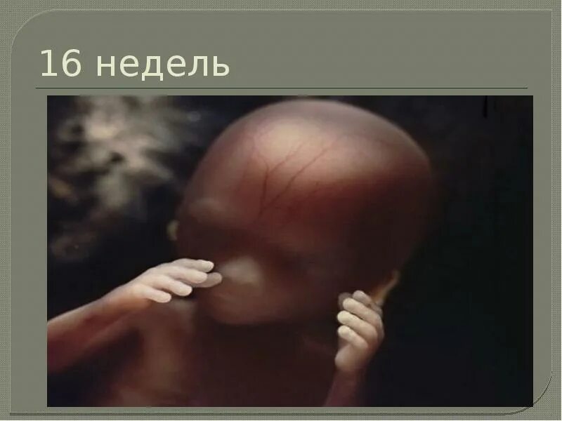 Плод в 16 недель фото Картинки КАК ВЫГЛЯДИТ ПЛОД В 16