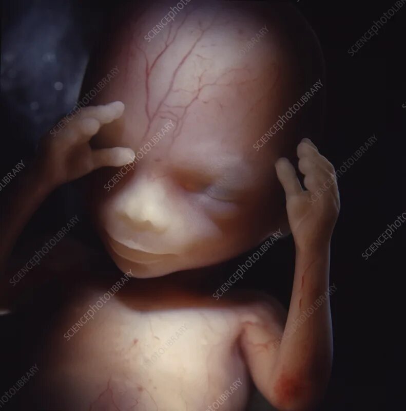 Плод в 16 недель фото Foetus, 16 weeks - Stock Image - C055/1873 - Science Photo Library