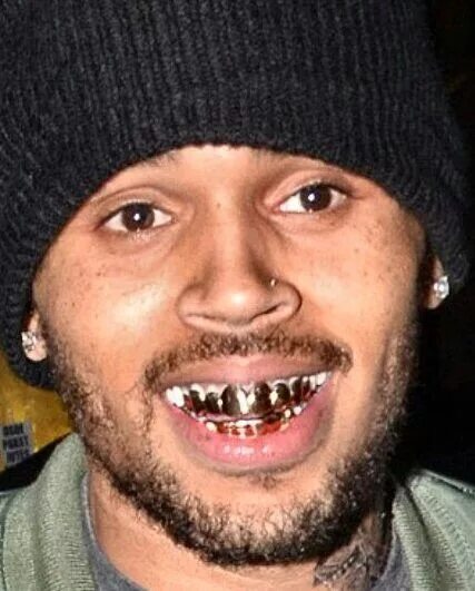 Плохие зубы фото Gold Grillz Chris brown, Celebrity trends, Teeth images