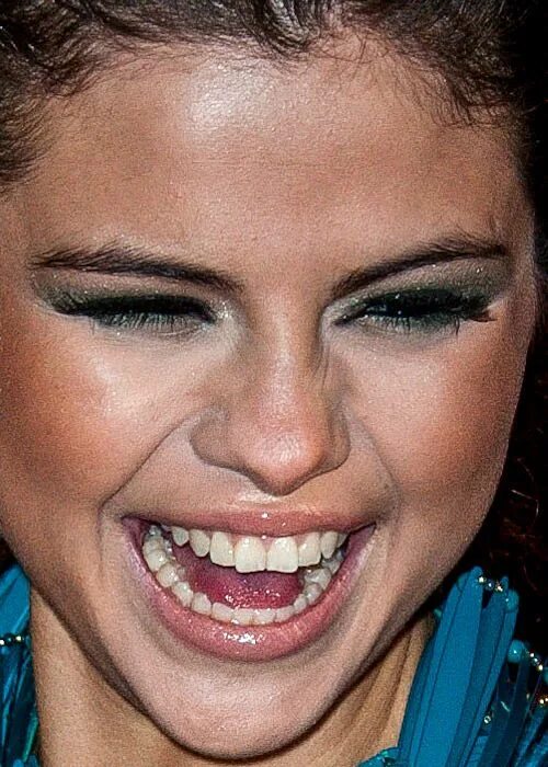 Плохие зубы фото у девушек celebritycloseup Selena gomez, Selena, Plastic surgery