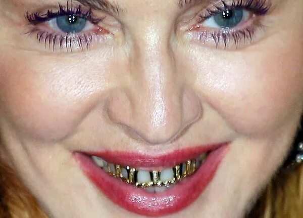 Плохие зубы фото у девушек Braces humor, Dentaltown, Madonna