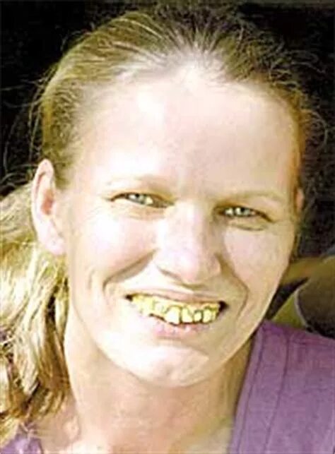 Плохие зубы фото у девушек Why do english have bad teeth?