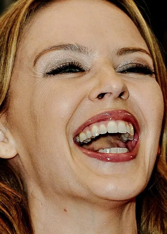 Плохие зубы фото у девушек Beautiful teeth, Perfect teeth, Kylie minogue