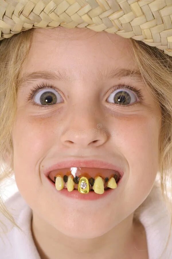 Плохие зубы фото у девушек Cocky Ugly Man with Rotten Teeth Giving a Thumbs Up Stock Image - Image of lunat