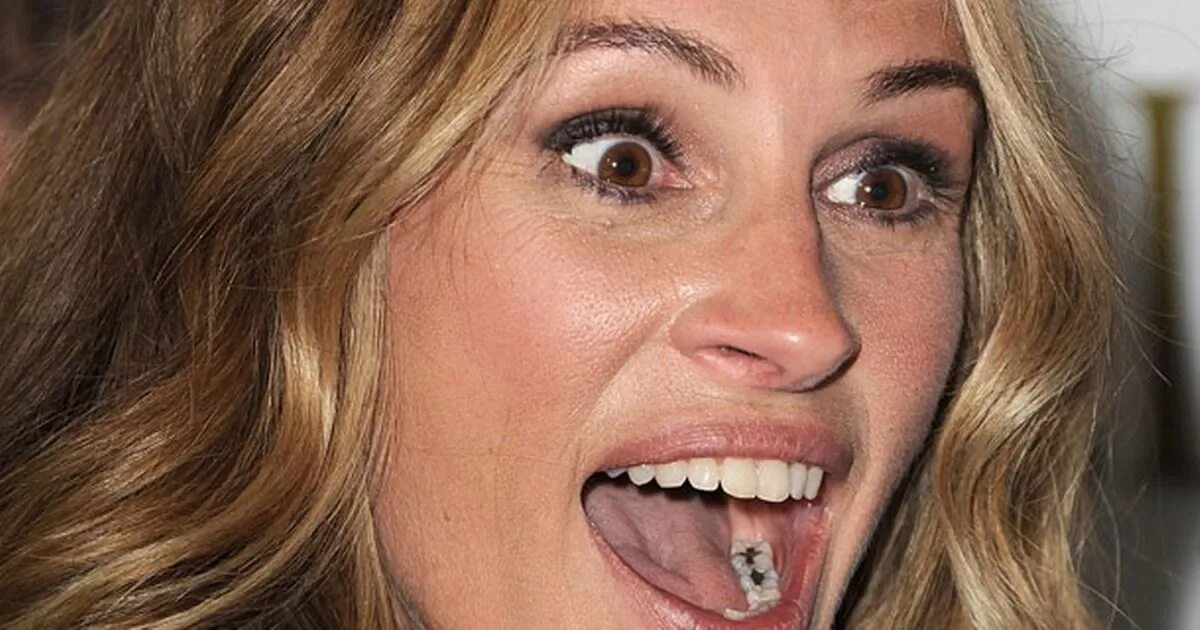 Плохие зубы фото у девушек Julia Roberts shows her fillings at Fireflies in the Garden premiere - Mirror On