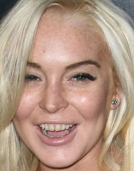 Плохие зубы фото у девушек Pin em Life as a dental assistant