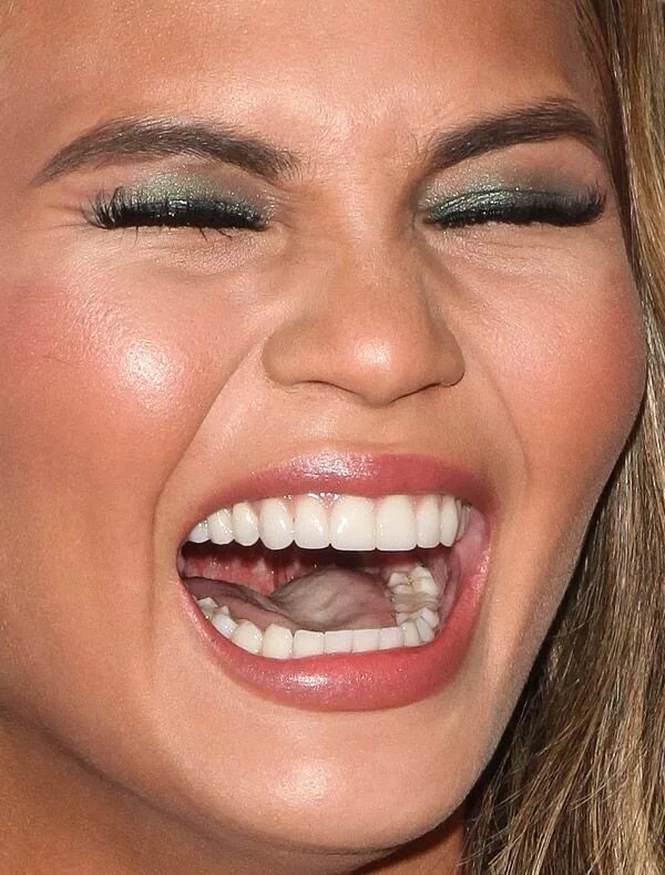 Плохие зубы фото у девушек Celebrity teeth, Perfect teeth, Perfect smile teeth