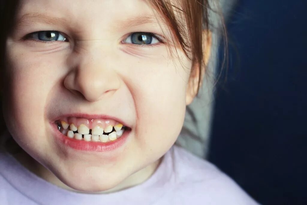 Плохие зубы у детей фото Learn All About the Different Stages of Teething in Children The Presence Portal