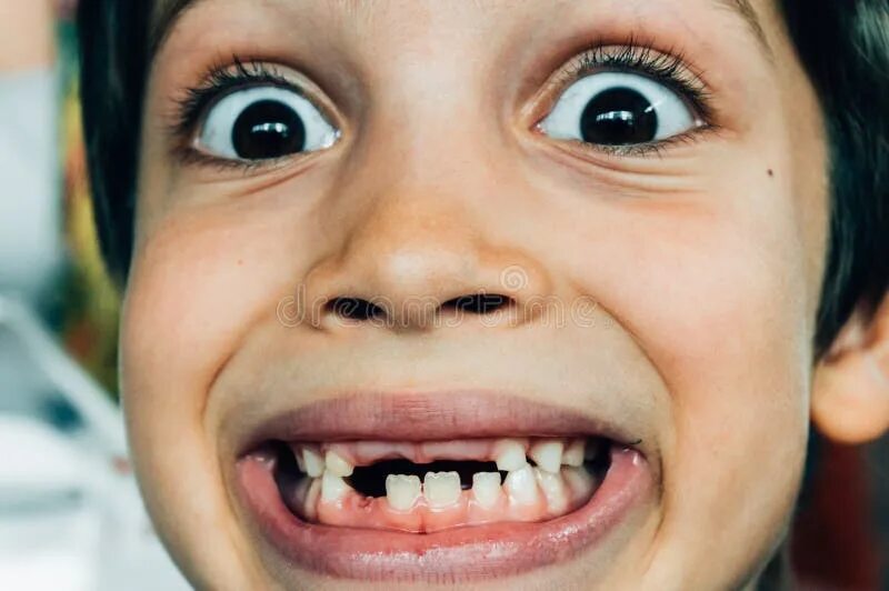 Плохие зубы у детей фото 492 Boy Smiling Missing Teeth Stock Photos - Free & Royalty-Free Stock Photos fr