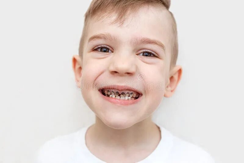 Плохие зубы у детей фото 16,941 Dental Boy Stock Photos - Free & Royalty-Free Stock Photos from Dreamstim