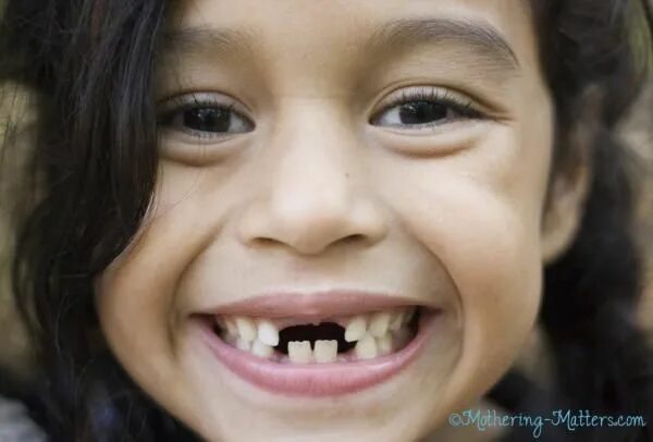 Плохие зубы у детей фото What to Expect When Kids Start Losing Their Teeth Tooth fairy, Kids teeth, Teeth