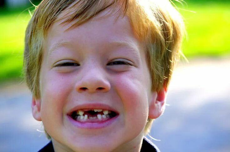 Плохие зубы у детей фото Tooth Fairy Inflation? Pediatric dentistry, Parenting, Cosmetic dentist