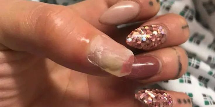 Плохое наращивание ногтей фото Pin on Nails