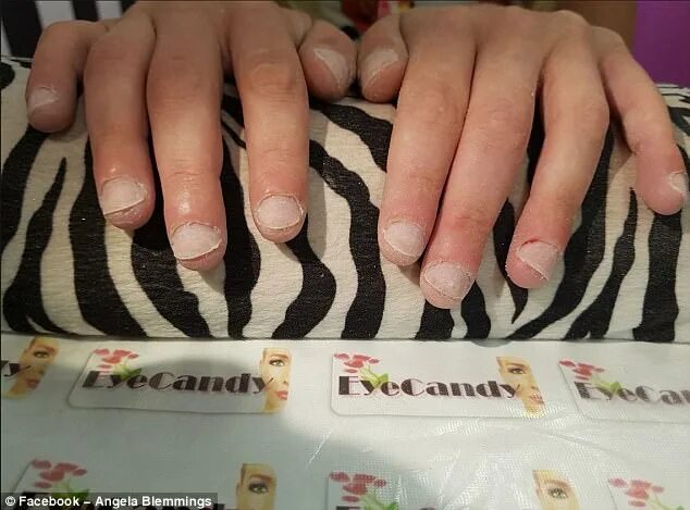 Плохое наращивание ногтей фото Manchester woman horrified by her 'round nails' manicure Daily Mail Online