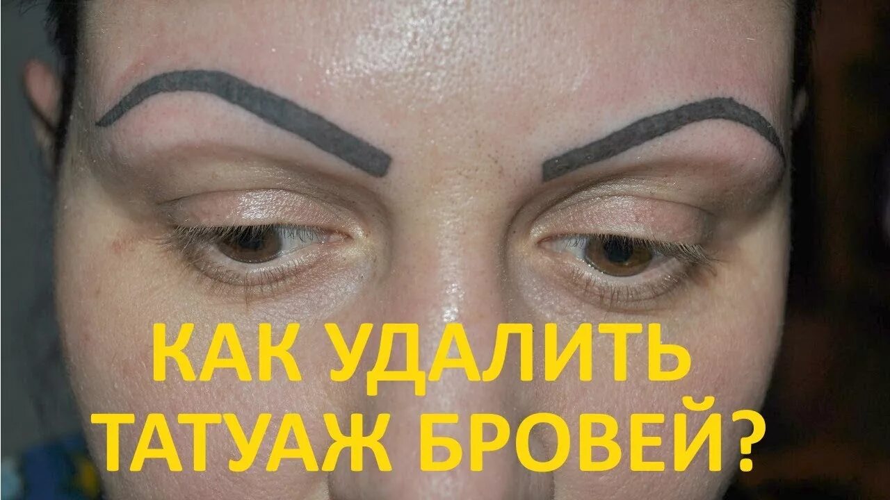 Плохой татуаж бровей Самые Простые Способы Удалить Татуаж бровей! - YouTube