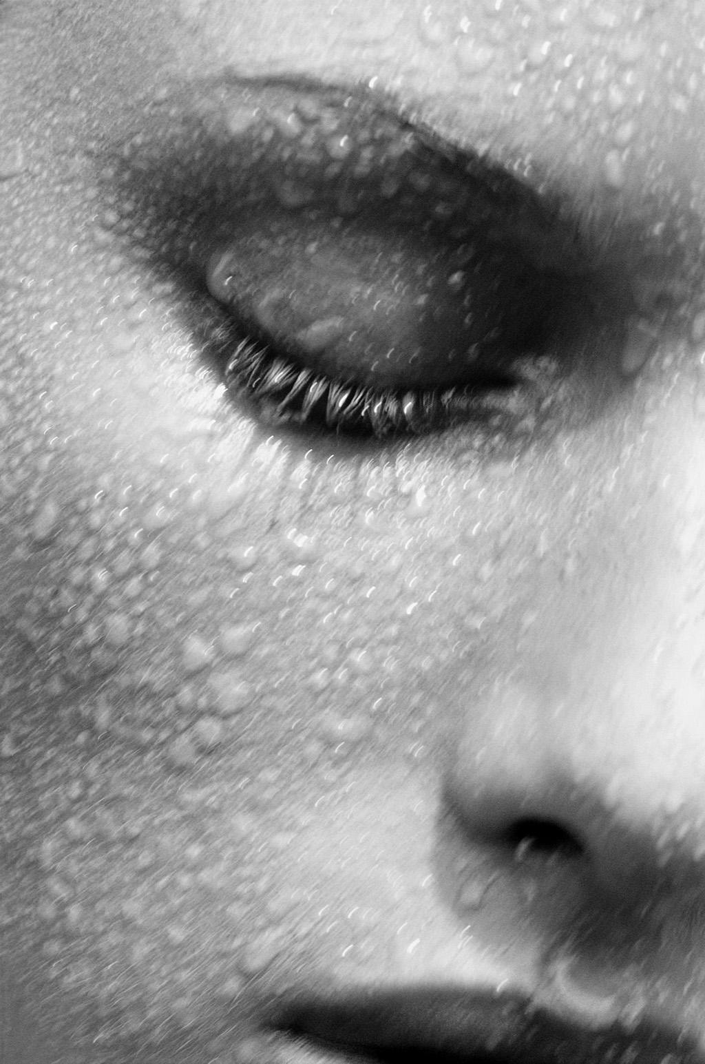 Плоские бородавки на лице фото What Life Is Like When You're Allergic to Your Own Sweat