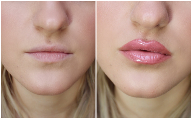 Плоские губы фото до и после CNY How To: Plumped Tinted Lips!
